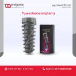 Powerbone implant Ø3,8-L 11,50 mm