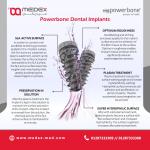 Powerbone implant Ø3,8-L 11,50 mm