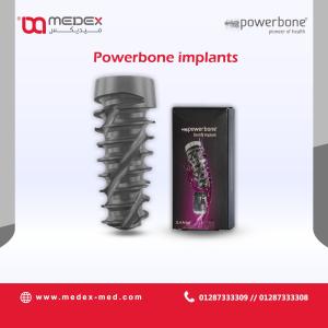 Powerbone implant Ø5,0-L 13,00 mm