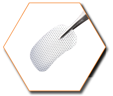 Biomaterials | Bone grafts