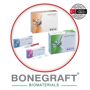 Biomaterials | Bone grafts